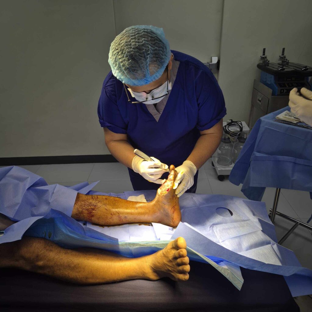 Comprehensive Guide to Debridement Services in Quezon City