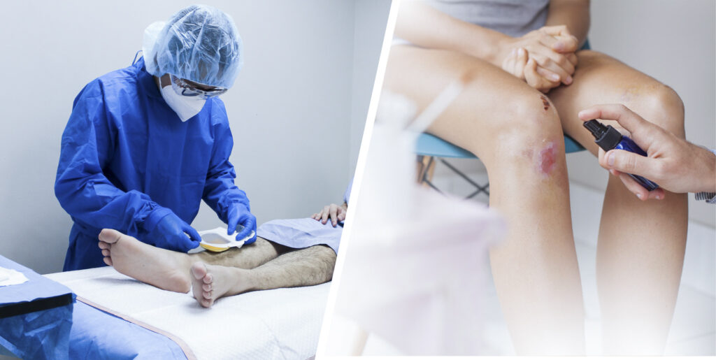 Wound Care Specialist Philippines Comprehensive Guide to Healing and Expert Care